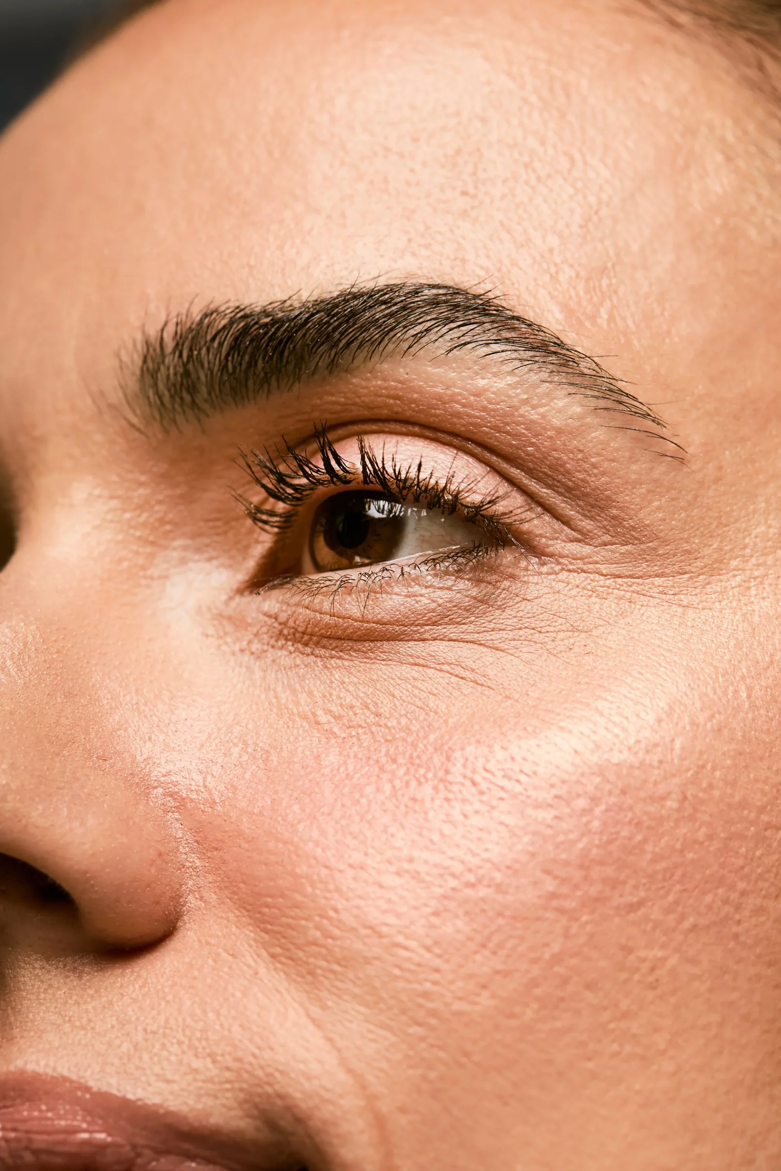 Olheiras: causas, tipos e tratamentos